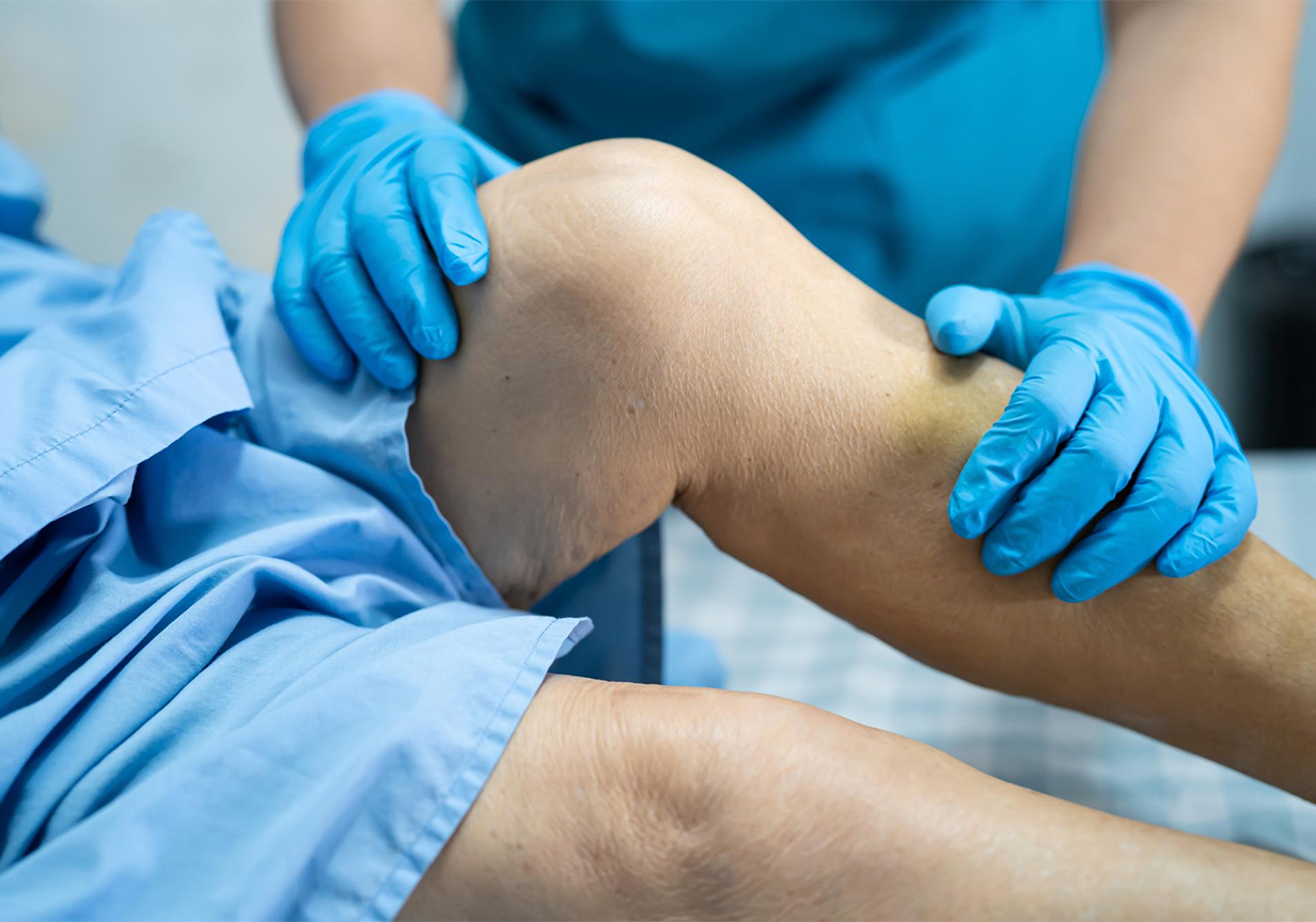 Artroscopia do Joelho